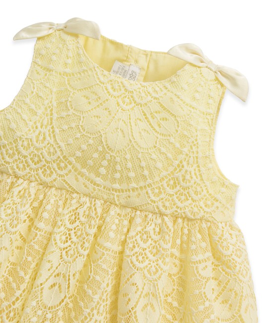 Yellow Lace Dress image number 3